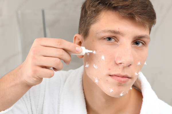 Teenage guy acne